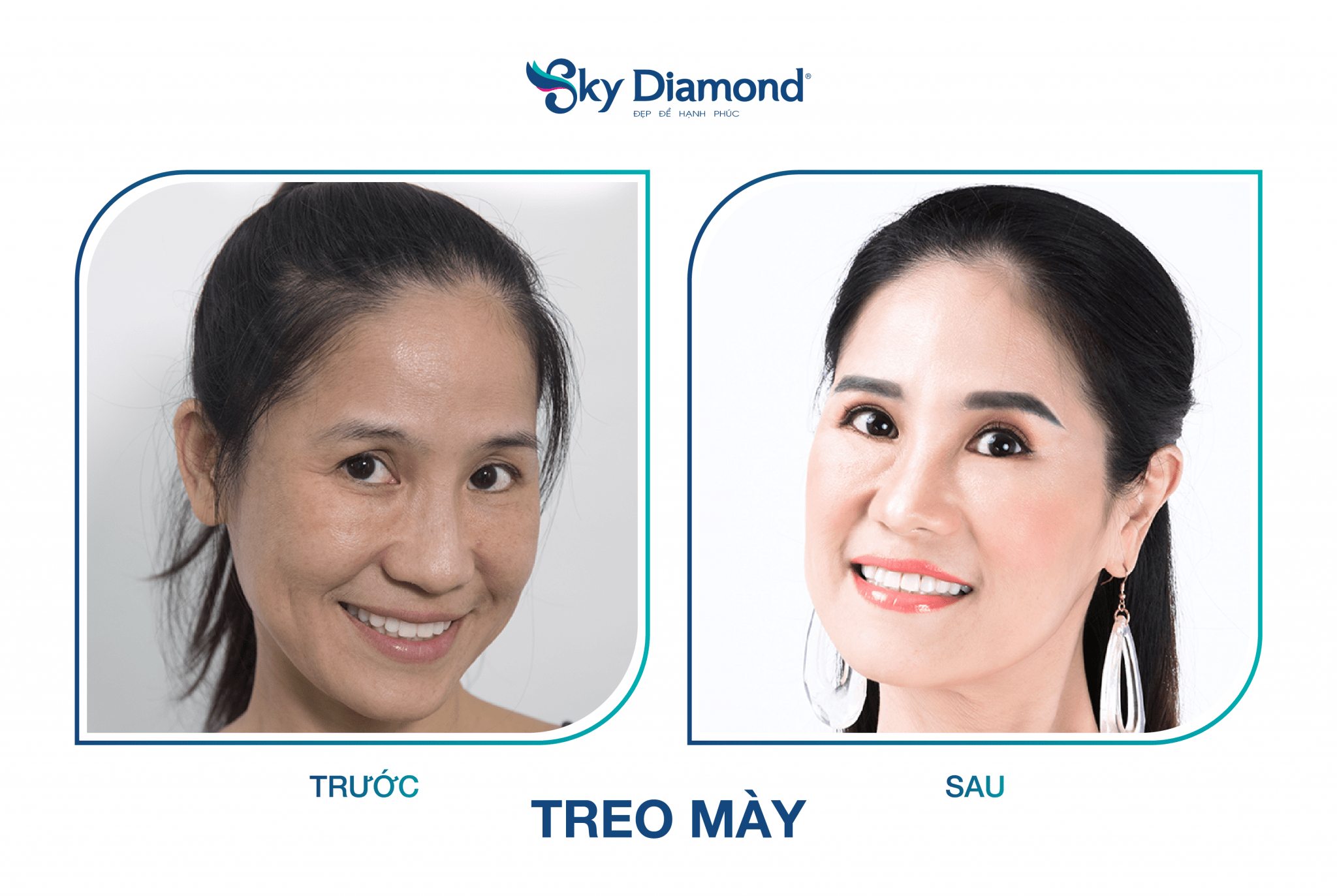 Diễn Viên Đào Vân Anh – Đại Sứ Hạnh Phúc Sky Diamond