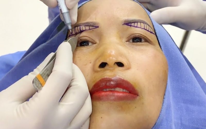Thực hiện nâng cung chân mày đơn giản, nhanh chóng