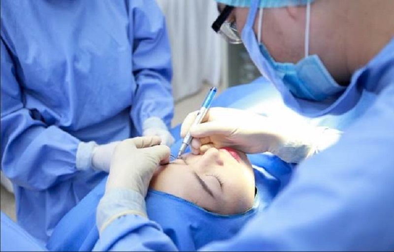 Phẫu thuật lấy mỡ bọng mắt không đau