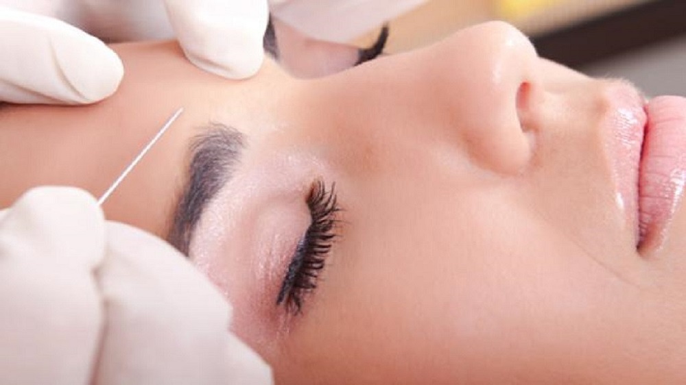 Nâng cung chân mày bao lâu thì hết sưng và đẹp tự nhiên?