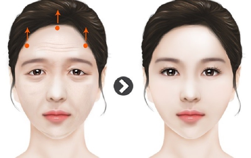 Nâng cung mày giúp dáng mày cân đối
