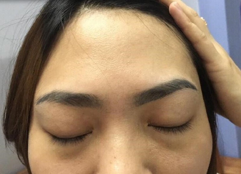 Lông mày bên cao bên thấp ảnh hưởng đến thẩm mỹ