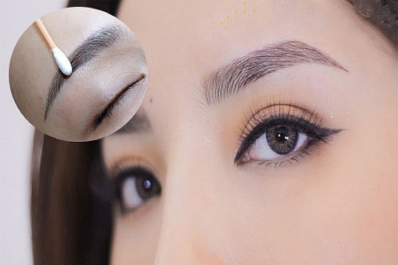 Chân mày lệch cao thấp không đều cần sửa lại