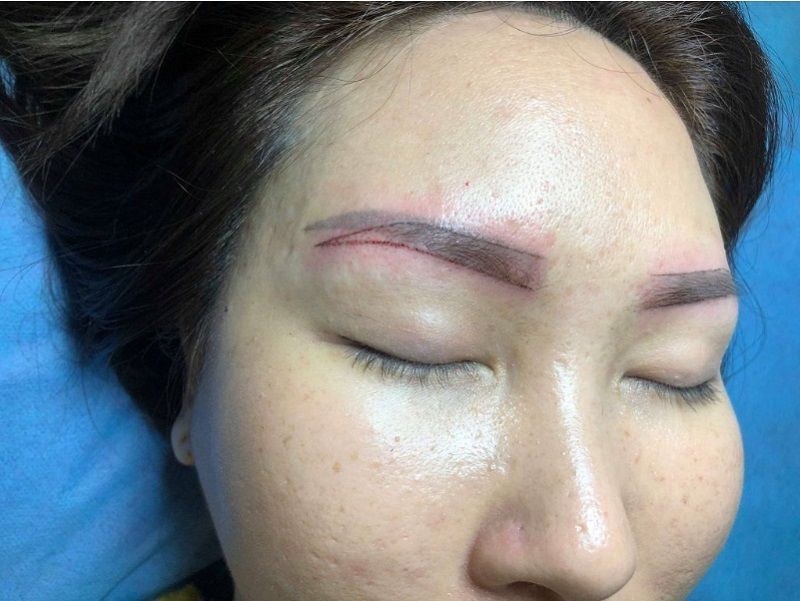 Sửa dáng lông mày đã phun hiện nay khá đơn giản
