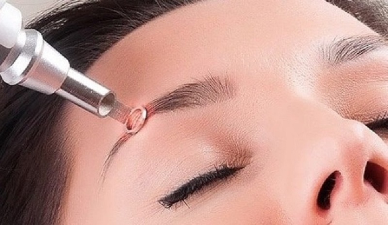 Sửa dáng lông mày đã phun bằng Laser