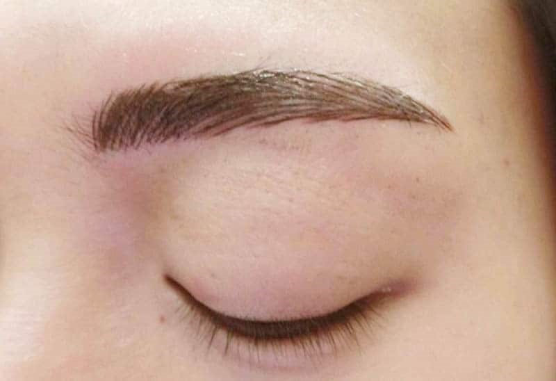 Xử lý mày hỏng giá bao nhiêu phụ thuộc vào phương pháp thực hiện