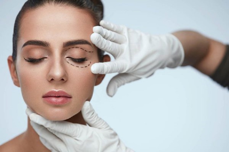 Đo vẽ vùng mí dưới cần loại bỏ