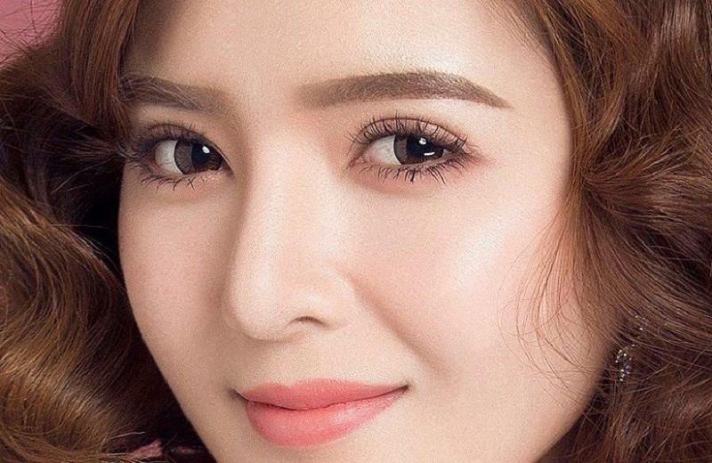 Cắt mí mắt giúp khắc phục tình trạng sụp mí bẩm sinh