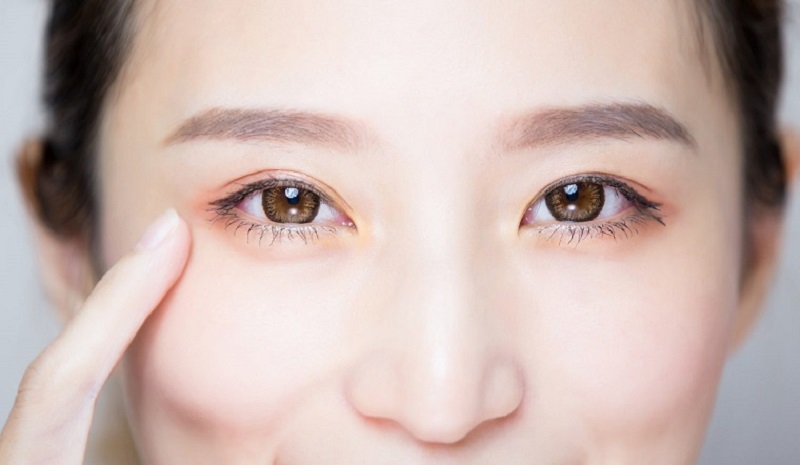 Phẫu thuật lấy mỡ bọng mắt mí dưới giúp trẻ hóa đôi mắt nhanh chóng