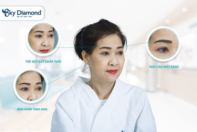 Phương pháp nâng cung mày nội soi