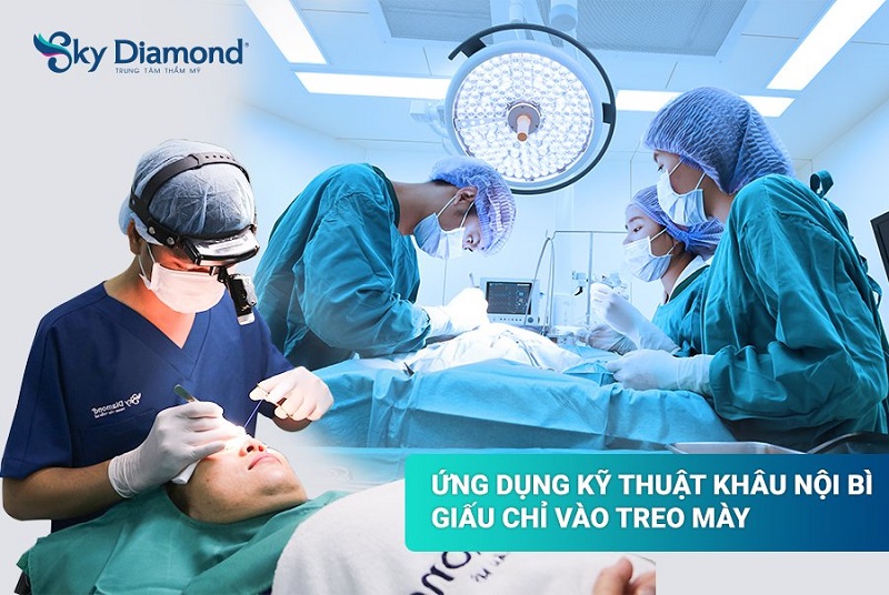 Nâng cung mày nam đẹp không để lại sẹo