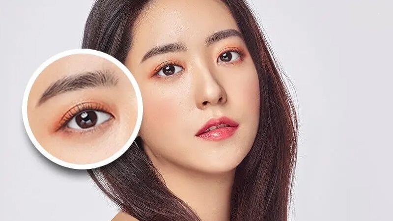 Treo cung chân mày giúp trẻ hóa vùng mắt
