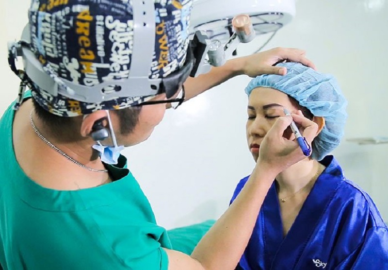 Treo mày được yêu thích nhờ mang đến nhiều ưu điểm vượt trội