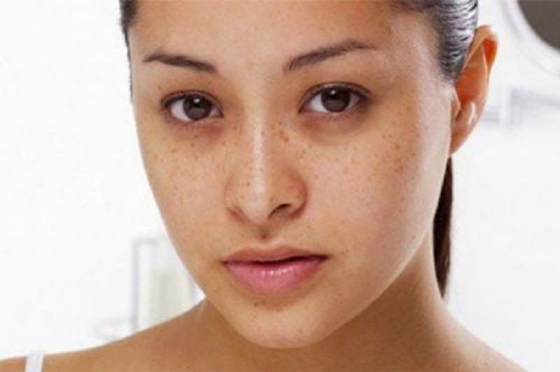 Xuất hiện nếp nhăn và quầng thâm mắt