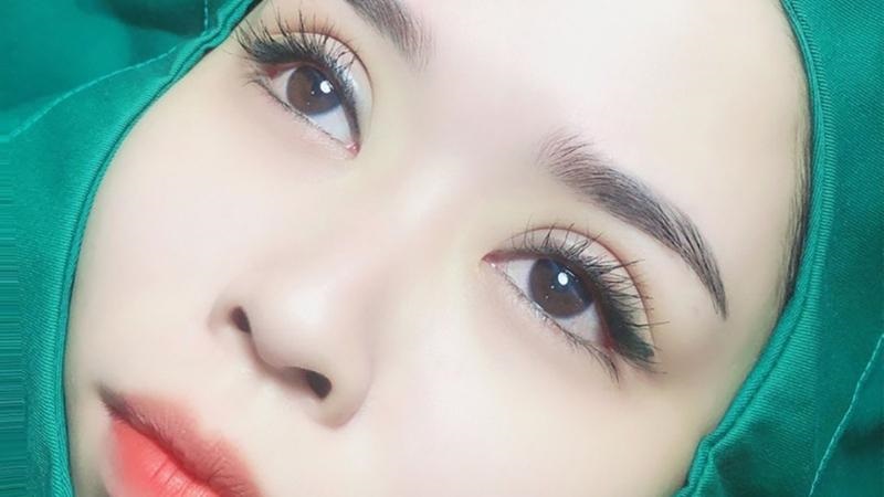 Cắt mí mắt hay nâng cung mày