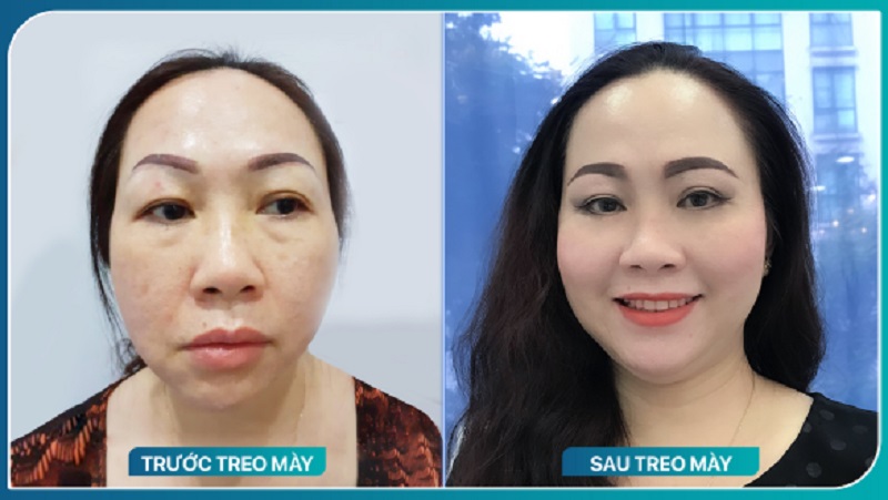 Lựa chọn địa chỉ treo cung được khách hàng đánh giá cao