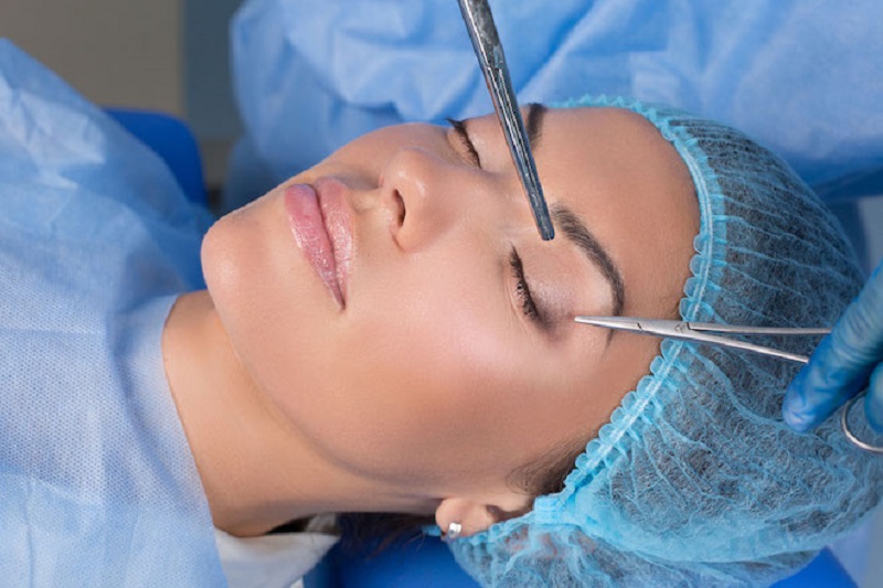 Chi phí nâng cung phụ thuộc vào tay nghề bác sĩ
