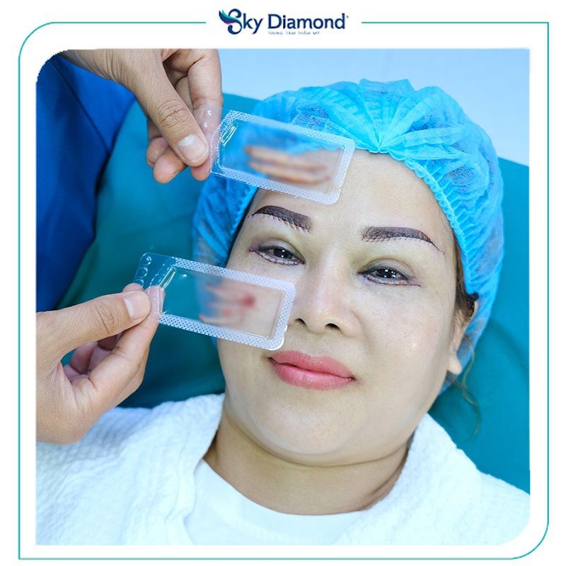 Sky Diamond - Địa chỉ cắt mí uy tín hàng đầu
