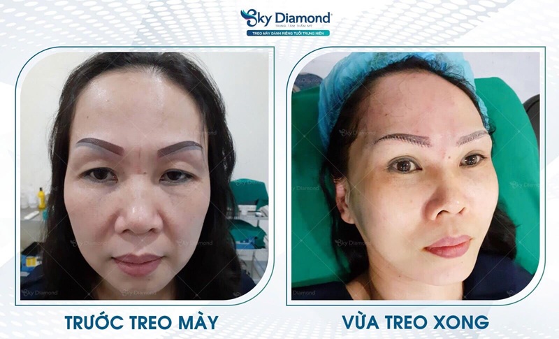 Sky Diamond tiếp nhận hàng ngàn khách hàng mỗi năm