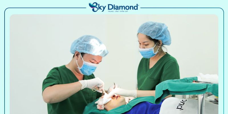 Chi phí treo mày phụ thuộc vào bác sĩ thực hiện